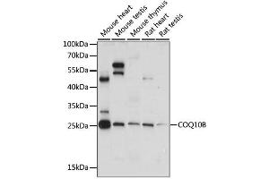 Western blot analysis of extracts of various cell lines, using COQ10B antibody. (COQ10B antibody)