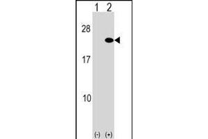 ARF5 antibody  (AA 80-108)