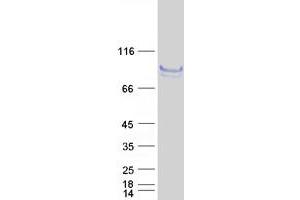 Western Blotting (WB) image for Fibronectin Leucine Rich Transmembrane Protein 1 (FLRT1) protein (Myc-DYKDDDDK Tag) (ABIN2721233)