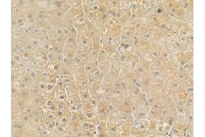 ABIN6257617 and ABIN6275640 at 1/100 staining human normal liver tissue by IHC-P.