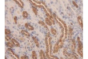 Immunohistochemistry (IHC) image for anti-Lactate Dehydrogenase B (LDHB) (AA 1-334) antibody (ABIN7433972)