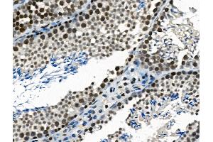 ABIN6265745 and ABIN6266869 at 1/100 staining Mouse testis tissue by IHC-P.