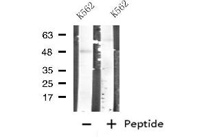 Western blot analysis of extracts from K562 cells, using CARBOXYPEPTIDASE A1 antibody. (CPA1 antibody  (Internal Region))