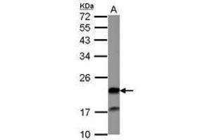 Image no. 1 for anti-Grancalcin, EF-Hand Calcium Binding Protein (GCA) (AA 7-217) antibody (ABIN1498410)