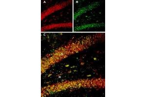 Multiplex staining of BDNF and proBDNF in rat hippocampus - Immunohistochemical staining of rat hippocampal dentate gyrus perfusion-fixed frozen sections using Guinea pig Anti-BDNF Antibody (ABIN7042969, ABIN7045379 and ABIN7045380), (1:300) and Anti-proBDNF Antibody (ABIN7043558, ABIN7044753 and ABIN7044754), (1:200). (Pro BDNF antibody  (Pro-Domain))