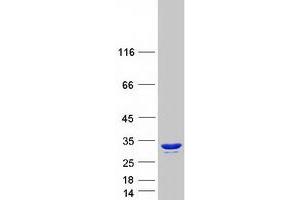 Validation with Western Blot (CRYBA1 Protein (Myc-DYKDDDDK Tag))