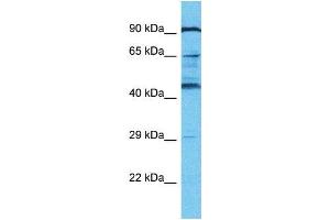 Western Blotting (WB) image for anti-KRAB-A Domain Containing 2 (KRBA2) (N-Term) antibody (ABIN2791626) (KRBA2 antibody  (N-Term))