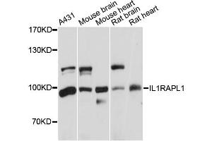 Western blot analysis of extracts of various cell lines, using IL1RAPL1 antibody (ABIN5971751) at 1:3000 dilution. (IL1RAPL1 antibody)