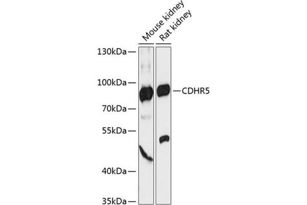 CDHR5 antibody  (AA 26-220)