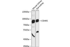 Western blot analysis of extracts of various cell lines, using CDHR5 antibody (ABIN6130563, ABIN6138301, ABIN6138302 and ABIN6217988) at 1:3000 dilution.