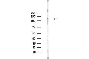 anti-MutS Homolog 3 (MSH3) (N-Term) antibody