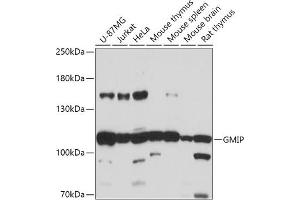 Western blot analysis of extracts of various cell lines, using GMIP antibody (ABIN7267369) at 1:1000 dilution. (GMIP antibody  (AA 1-91))