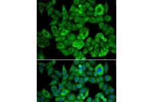 Immunofluorescence analysis of U2OS cells using OGDH Polyclonal Antibody (alpha KGDHC antibody)