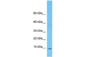 Host: Rabbit Target Name: TIMM10 Sample Type: 721_B Whole Cell lysates Antibody Dilution: 1. (TIMM10 antibody  (Middle Region))