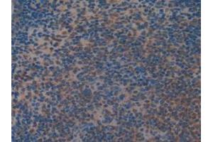 IHC-P analysis of Mouse Spleen Tissue, with DAB staining. (MEK2 antibody  (AA 44-313))
