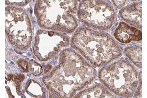 ABIN6266990 at 1/100 staining human kidney tissue sections by IHC-P. (FAP antibody  (Internal Region))
