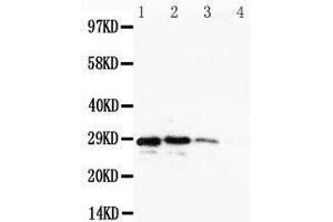 Lane 4: Recombinant Human CuEDC2 Protein 1. (CUEDC2 antibody  (C-Term))