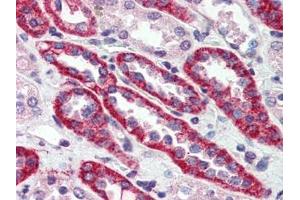 Human Kidney (formalin-fixed, paraffin-embedded) stained with CASRat 15 µg/ml followed by biotinylated goat anti-rabbit IgG secondary antibody, alkaline phosphatase-streptavidin and chromogen. (CASR antibody  (N-Term))