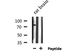 Western blot analysis of extracts from Rat brain lysate, using RFWD2 antibody. (RFWD2 antibody  (Internal Region))