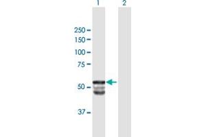 Western Blot analysis of GAL3ST1 expression in transfected 293T cell line by GAL3ST1 MaxPab polyclonal antibody. (GAL3ST1 antibody  (AA 1-423))