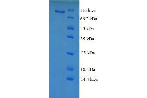 SDS-PAGE (SDS) image for Protein S (PROS) (AA 42-675) protein (GST tag) (ABIN5710155)