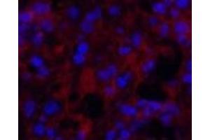 Immunofluorescence analysis of Human appendix tissue using MICU1 Monoclonal Antibody at dilution of 1:200. (MICU1 antibody)