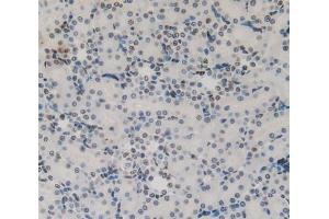 IHC-P analysis of kidney tissue, with DAB staining. (Cytokeratin 1 antibody  (AA 489-625))