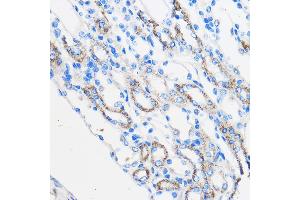 Immunohistochemistry of paraffin-embedded Mouse kidney using R Rabbit pAb (ABIN6131585, ABIN6146704, ABIN6146705 and ABIN6222716) at dilution of 1:50 (40x lens). (Chemerin antibody  (AA 17-163))