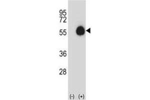 Western blot analysis of CD33 antibody and 293 cell lysate (2 ug/lane) either nontransfected (Lane 1) or transiently transfected (2) with the CD33 gene. (CD33 antibody  (AA 88-117))