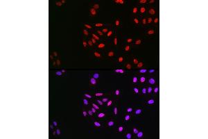 Immunofluorescence analysis of U2OS cells using Phospho-Cyclin E1-T395 Rabbit pAb (ABIN3019434, ABIN3019435, ABIN3019436 and ABIN6225368) at dilution of 1:100 (40x lens). (Cyclin E1 antibody  (pThr395))