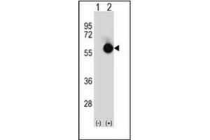 Western blot analysis of CTBP2 (arrow) using CTBP2 Antibody (N-term) Cat. (CTBP2 antibody  (N-Term))