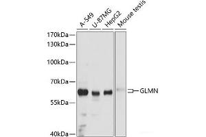 Western blot analysis of extracts of various cell lines using GLMN Polyclonal Antibody at dilution of 1:3000. (GLMN antibody)