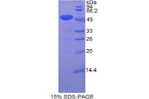 SDS-PAGE analysis of Human CDNF Protein.