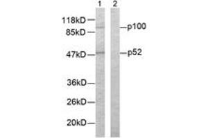 Western blot analysis of extracts from ovary cancer cells, using NF-kappaB p100/p52 (Ab-865) Antibody. (NFKB2 antibody  (AA 833-882))