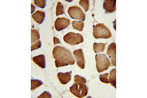 Formalin-fixed and paraffin-embedded human skeletal muscle reacted with NPT Antibody (Center), which was peroxidase-conjugated to the secondary antibody, followed by DAB staining. (NAMPT antibody  (AA 400-426))