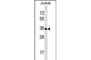 UPK3B Antibody (Center) (ABIN1538017 and ABIN2849255) western blot analysis in Jurkat cell line lysates (35 μg/lane).