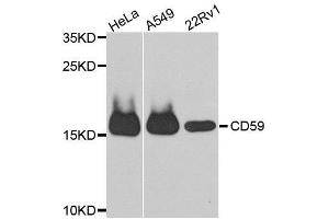 Western blot analysis of extracts of various cell lines, using CD59 antibody. (CD59 antibody  (AA 26-128))