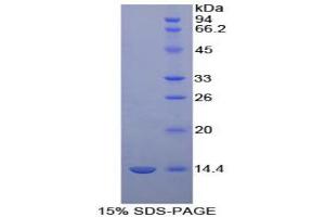 SDS-PAGE analysis of Cow D-Aspartate Oxidase Protein. (DDO Protein)