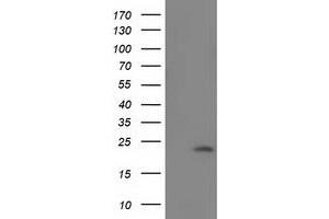 Western Blotting (WB) image for anti-Superoxide Dismutase 2, Mitochondrial (SOD2) antibody (ABIN1499530)