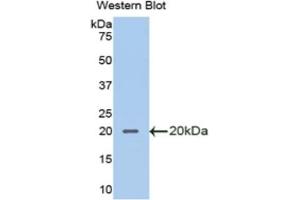 Detection of Recombinant SLPI, Mouse using Polyclonal Antibody to Secretory Leukocyte Peptidase Inhibitor (SLPI) (SLPI antibody  (AA 20-131))