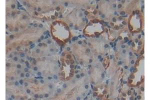 Immunohistochemistry (IHC) image for anti-Tumor Necrosis Factor Receptor Superfamily, Member 11a, NFKB Activator (TNFRSF11A) (AA 31-214) antibody (ABIN7434632)