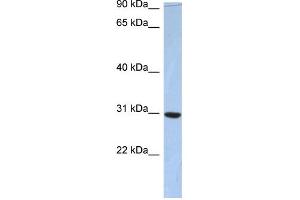 WB Suggested Anti-C16orf65 Antibody Titration: 0. (PDZD9 antibody  (Middle Region))