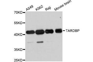 Western blot analysis of extracts of various cell lines, using TARDBP antibody. (TARDBP antibody)
