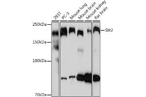 Western blot analysis of extracts of various cell lines, using Slit2 Rabbit mAb (ABIN7270335) at 1:1000 dilution. (SLIT2 antibody)