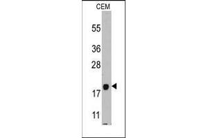 Western blot analysis of anti-PPBP Pab in CEM cell line lysates (35ug/lane). (CXCL7 antibody  (C-Term))