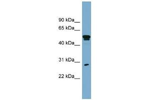 WB Suggested Anti-SLA Antibody Titration:  0. (SLA antibody  (Middle Region))