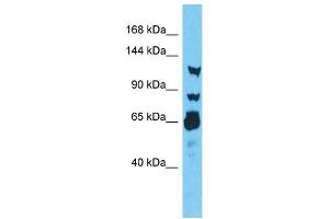 Host:  Rabbit  Target Name:  RNF213  Sample Type:  Thyroid Tumor lysates  Antibody Dilution:  1. (RNF213 antibody  (N-Term))