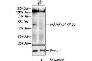 Western blot analysis of extracts of 293 cells, using Phospho-AMPKβ1-S108 antibody (ABIN6135184, ABIN6136014, ABIN6136015 and ABIN6225614) at 1:1000 dilution. (PRKAB1 antibody  (pSer108))