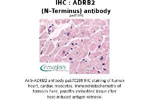 Image no. 1 for anti-Adrenergic, beta-2-, Receptor, Surface (ADRB2) (Extracellular Domain), (N-Term) antibody (ABIN1731583) (beta 2 Adrenergic Receptor antibody  (Extracellular Domain, N-Term))
