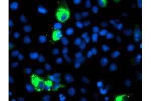 Immunofluorescence (IF) image for anti-Cytochrome P450, Family 2, Subfamily J, Polypeptide 2 (CYP2J2) antibody (ABIN1497729) (CYP2J2 antibody)